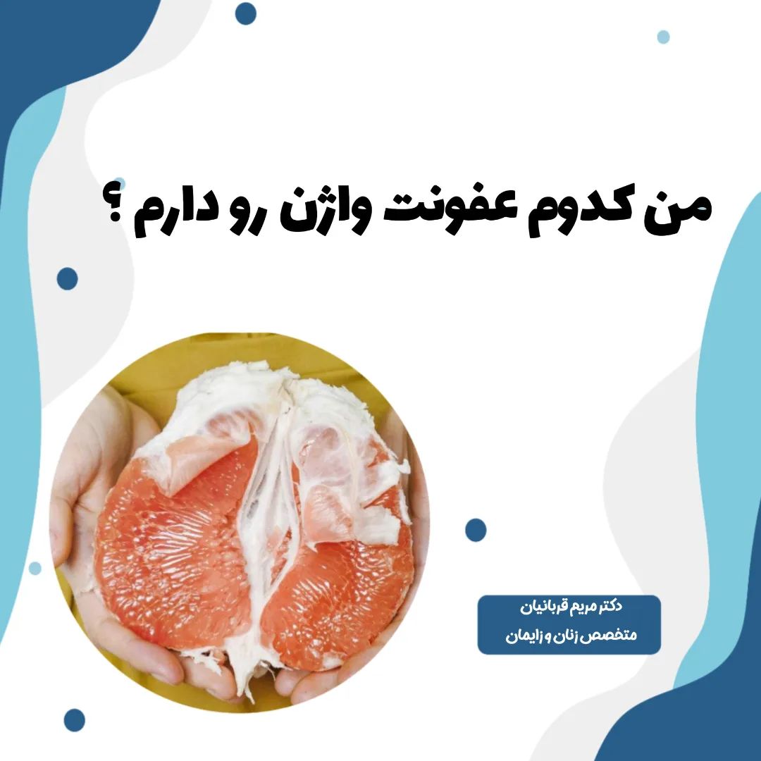 انواع عفونت واژن